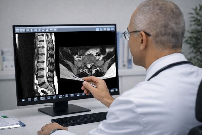 Imagerie rachidienne